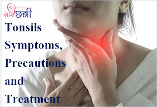 Best Home remedies to cure Tonsils fast