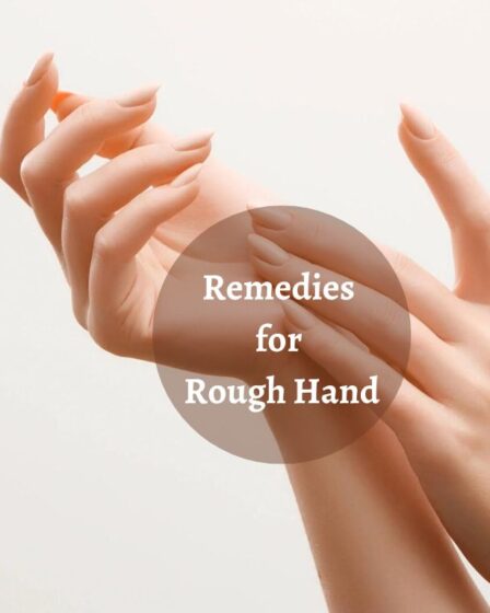 Remedies for Rough Hand